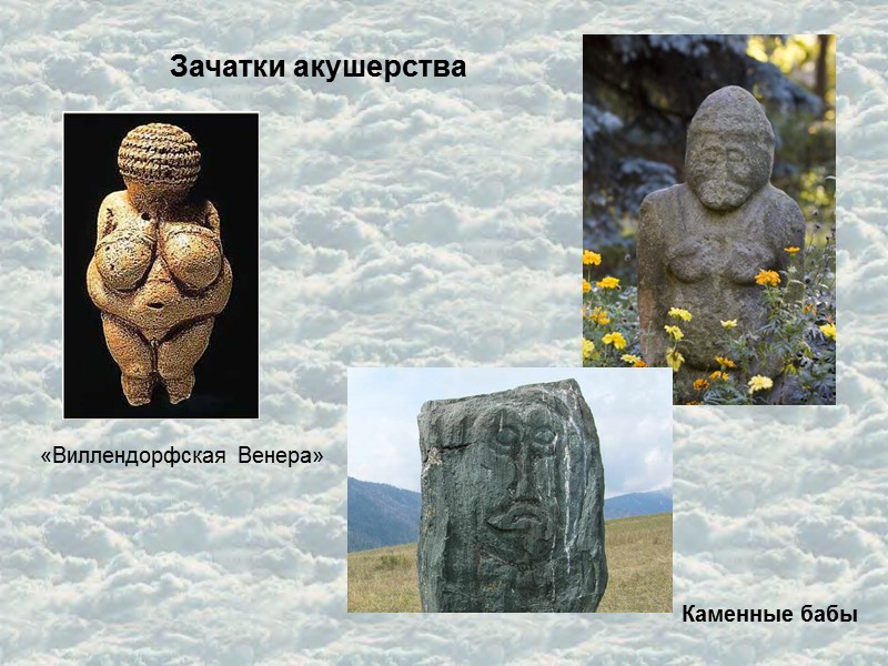 Зачатки акушерства «Виллендорфская Венера» Каменные бабы